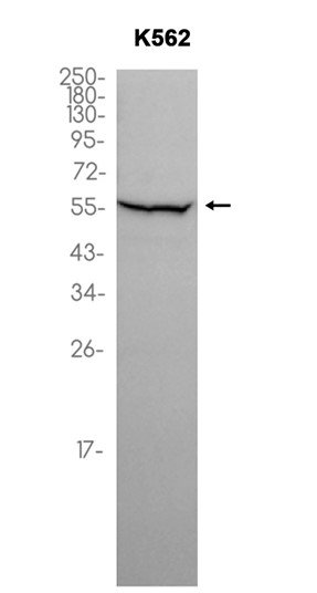 NAMPT (YD16240) Rabbit mAb