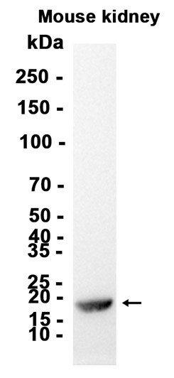 AYD12386