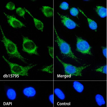 DRP1 (YD12235) Rabbit mAb