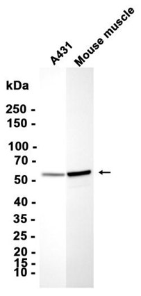 AYD15047