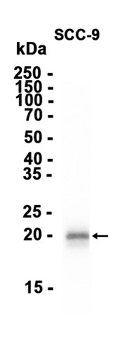 AYD11974