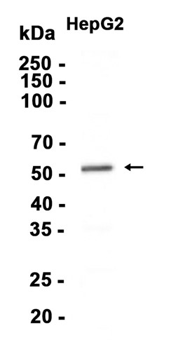 CaMKII (YD14655) Rabbit mAb