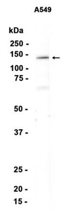 AYD13720