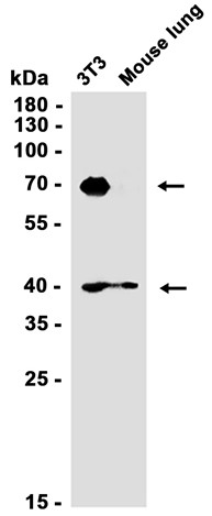 Mesothelin (YD19559) Rabbit mAb