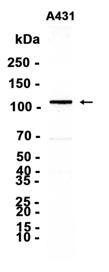 AYD15943