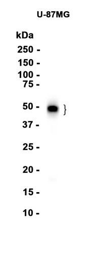 AYD15423