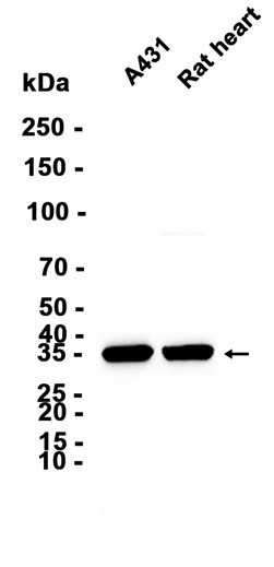 AYD14610