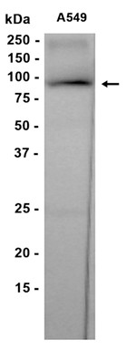 AYD11651