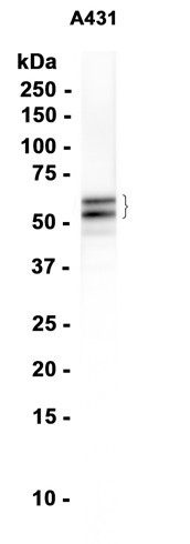 NAP1L1 (YD36174) Rabbit mAb