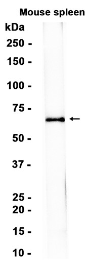 TGFBI (YD20596) Rabbit mAb