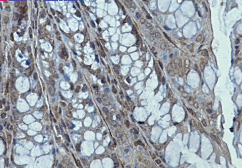Creatine Kinase B type (YD18824) Rabbit mAb