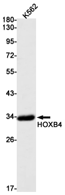 AYD11591