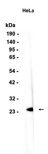 AYD14637