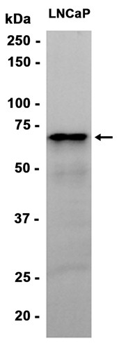 AYD11675