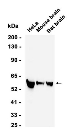 AYD11648