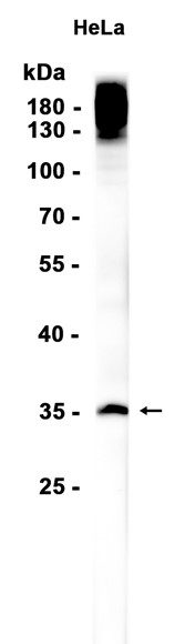 AYD15980