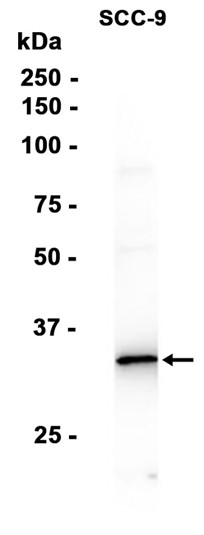 AYD12935