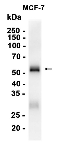 AYD14520