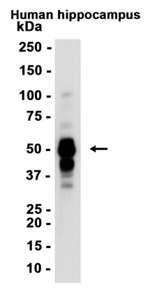 Phospho-Tau (Thr50) (YD13609) Rabbit mAb