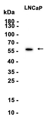Phospho-AKT1 (Ser473) (YD14737) Rabbit mAb