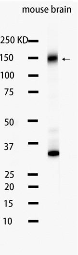 Trk (pan) (YD31317) Rabbit mAb