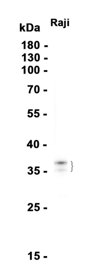 AYD11856
