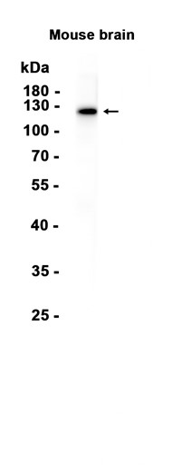 AYD15040