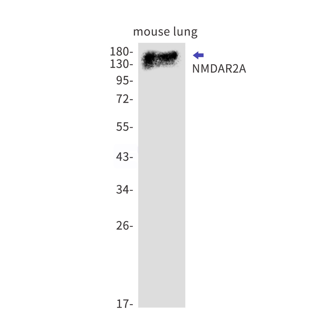 NMDAR2A (YD11450) Rabbit mAb