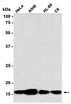 Phospho-Histone H3 (Ser10/Thr11) (YD32387) Rabbit mAb