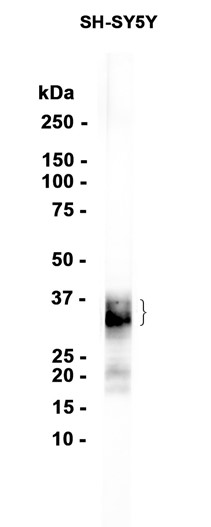 AYD12391