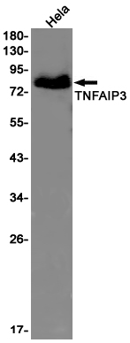 AYD11756