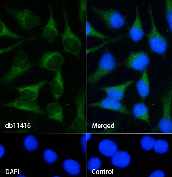 Creatine kinase B type (YD20638) Rabbit mAb