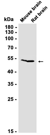 Tryptophan tRNA Ligase (YD34032) Rabbit mAb