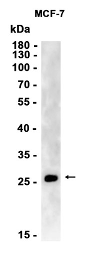 Aquaporin 5 (YD12194) Rabbit mAb