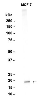 Ferritin light chain (YD18682) Rabbit mAb