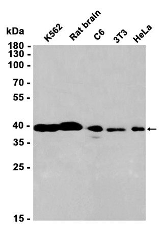 AYD11830