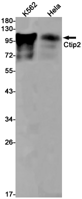 AYD12025