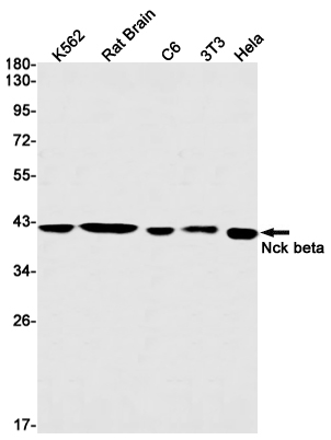 Nck beta (YD13588) Rabbit mAb