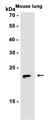 AYD12397