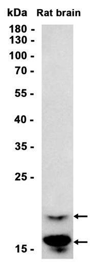 AYD11667