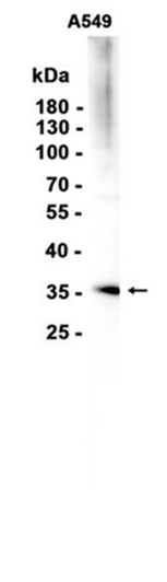 AYD16047