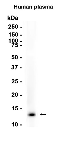 AYD15165