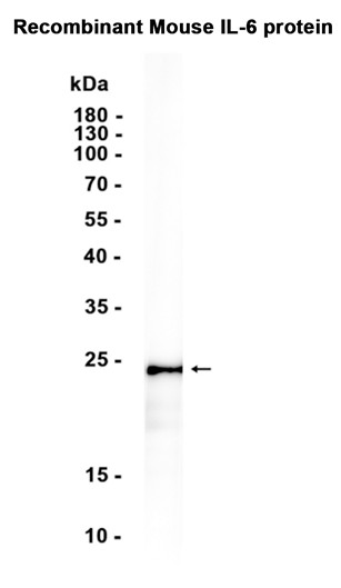 IL-6 (YD18277) Rabbit mAb