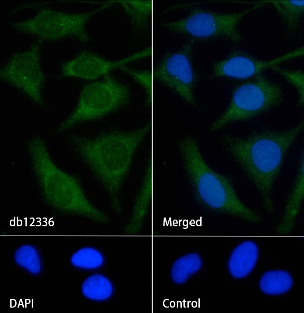 Prostaglandin dehydrogenase 1 (YD13005) Rabbit mAb