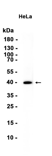 Aldolase A (YD34962) Rabbit mAb