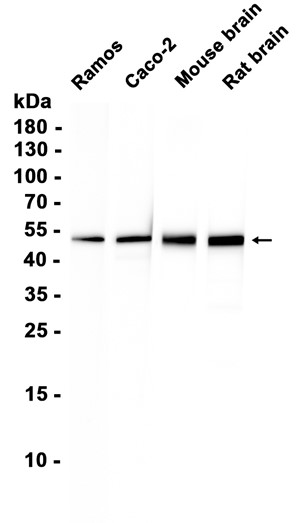 NPY5R (YD36186) Rabbit mAb