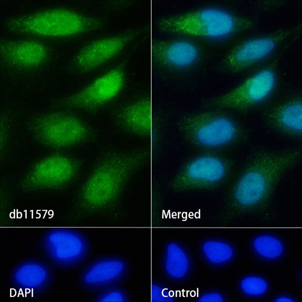PPAR gamma (YD35289) Rabbit mAb