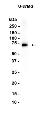 AYD15525