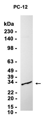AYD14394
