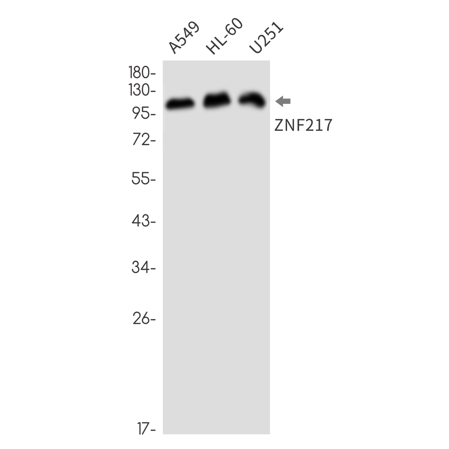 ZNF217 (YD31261) Rabbit mAb